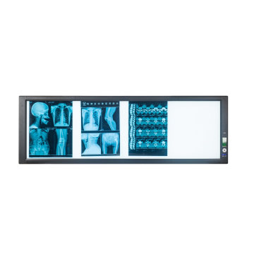 Hospital Medical Film Viewer X Ray Viewer LED X-ray Viewing Box X-ray Viewing Light Box